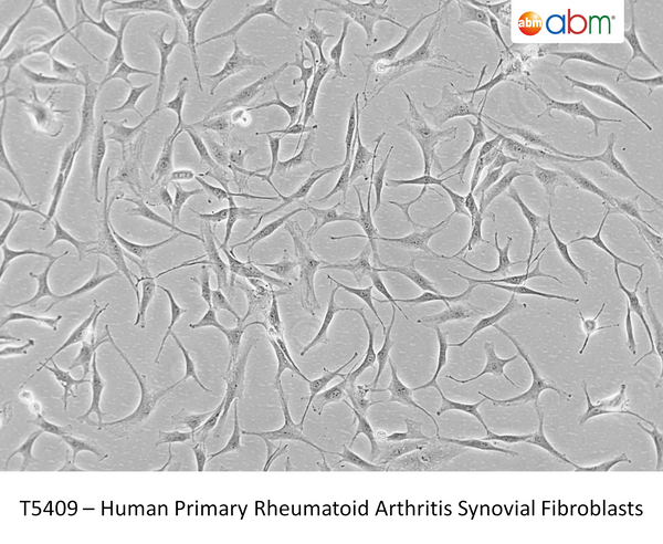 Human Primary Rheumatoid Arthritis Synovial Fibroblasts | Applied Biological Materials (abm)