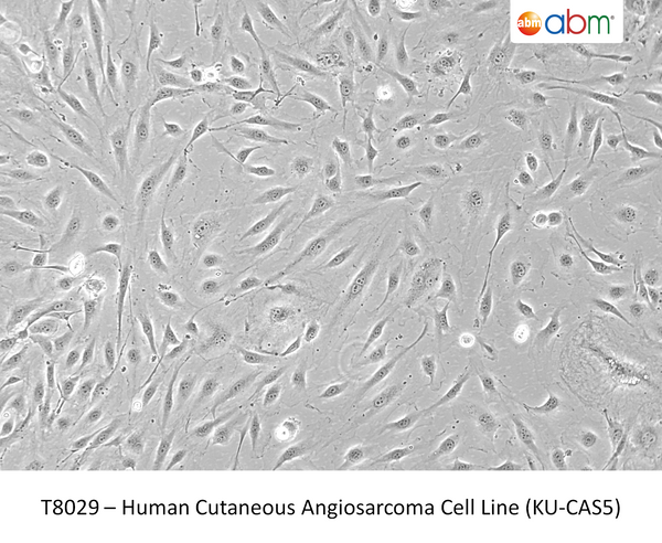 Human Cutaneous Angiosarcoma Cell Line (KU-CAS5) | Applied Biological Materials (abm)