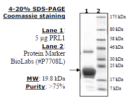 PRL1 (2-173), His-tag Recombinant – Figure 1 of 2
