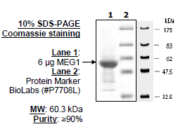 MEG-1 (PTPN4), GST-tag Recombinant – Figure 1 of 4