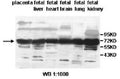 Anti-ALG8 Antibody – Figure 1 of 1