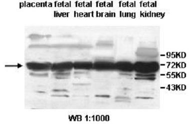 Anti-ALG8 Antibody – Figure 1 of 1
