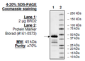 BRD2 (BD1+BD2), His-tag Recombinant – Figure 1 of 1