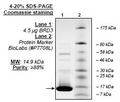 BRD3 (BD1), His-tag Recombinant – Figure 1 of 2