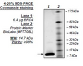 BRD4 (BD2), His-tag Recombinant – Figure 1 of 4