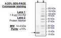 CECR2, His-tag Recombinant – Figure 1 of 2