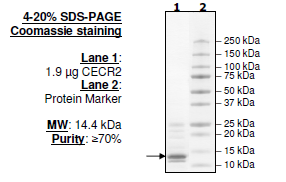 CECR2, His-tag Recombinant – Figure 1 of 2