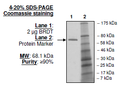 BRDT (BD1+BD2), GST-tag Recombinant – Figure 1 of 1