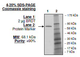 BRDT (BD1+BD2), GST-tag Recombinant – Figure 1 of 1