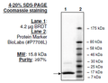 BRDT (BD2), His-tag Recombinant – Figure 1 of 1