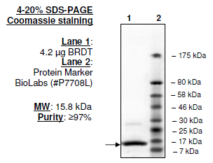 BRDT (BD2), His-tag Recombinant – Figure 1 of 1