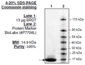BRDT (BD1), His-tag Recombinant – Figure 1 of 2