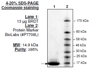 BRDT (BD1), His-tag Recombinant – Figure 1 of 2