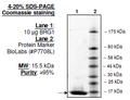 SMARCA4 (BRG1), His-tag Recombinant – Figure 1 of 1