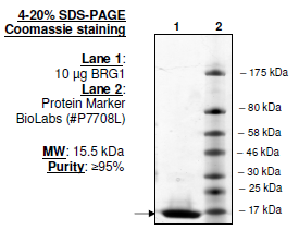 SMARCA4 (BRG1), His-tag Recombinant – Figure 1 of 1