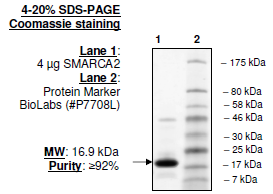 SMARCA2, His-tag Recombinant – Figure 1 of 1