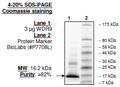 WDR9/BRWD1 (BD2), His-tag Recombinant – Figure 1 of 1