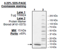 TRIM24 (TIF1), His-tag Recombinant – Figure 1 of 1
