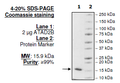 ATAD2B (KIAA1240), His-tag Recombinant – Figure 1 of 1