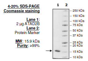ATAD2B (KIAA1240), His-tag Recombinant – Figure 1 of 1