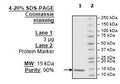 CREBBP (KAT3A), His-tag Recombinant – Figure 1 of 1
