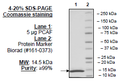 PCAF (KAT2B), His-tag Recombinant – Figure 1 of 1