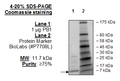 PB1 (BD4), His-tag Recombinant – Figure 1 of 1