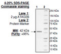 ATAD2B (KIAA1240), GST-tag Recombinant – Figure 1 of 2