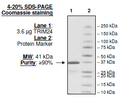 TRIM24 (TIF1), GST-tag Recombinant – Figure 1 of 2
