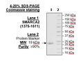SMARCA2, His-Tag, Biotin-Labeled Recombinant – Figure 1 of 1