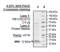 PB1 (BD6), His-tag Recombinant – Figure 1 of 1