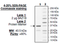 BAZ1B, GST-tag Recombinant – Figure 1 of 1