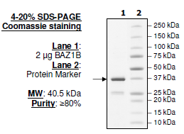 BAZ1B, GST-tag Recombinant – Figure 1 of 1