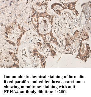 Anti-EPHA4 Antibody – Figure 1 of 1