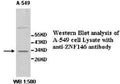 Anti-ZNF146 Antibody – Figure 1 of 1
