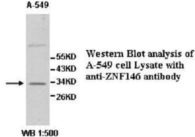 Anti-ZNF146 Antibody – Figure 1 of 1