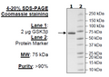 GSK3β, GST-tag, His-tag Recombinant – Figure 1 of 4