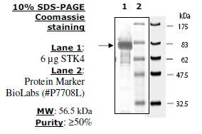 STK4(MST1), GST-tag Recombinant – Figure 1 of 2