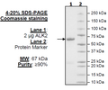ALK2 (ACVR1), GST-tag Recombinant – Figure 1 of 2