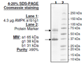AMPK (A1/B1/G1), His-tags Recombinant – Figure 1 of 4