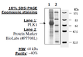 PLK1, His-tag Recombinant – Figure 1 of 4