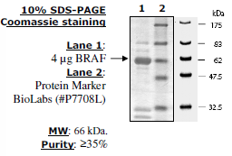 BRAF, GST-tag Recombinant – Figure 1 of 5