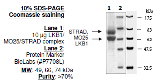 LKB1/MO25/STRAD Complex Recombinant – Figure 1 of 2