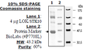 Lok1 (Stk10), His-tag Recombinant – Figure 1 of 1