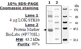 Lok1 (Stk10), His-tag Recombinant – Figure 1 of 1