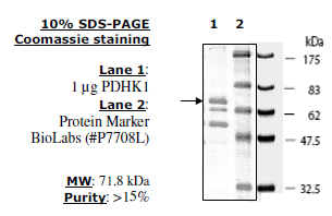 PDHK1, GST-Tag Recombinant – Figure 1 of 1