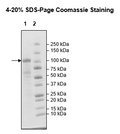 NIK, GST-Tag, His-Tag Recombinant – Figure 1 of 1