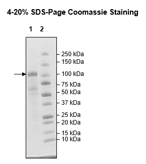 NIK, GST-Tag, His-Tag Recombinant – Figure 1 of 1