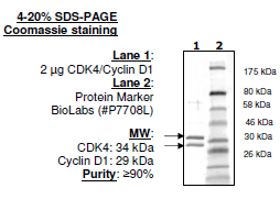 CDK4(EE,T172A)/Cyclin D1, His-tag Recombinant – Figure 1 of 1