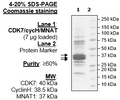 CDK7/CyclinH1/MNAT1, His-tags Recombinant – Figure 1 of 4